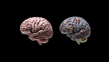 Влияние алкоголя на нервную систему