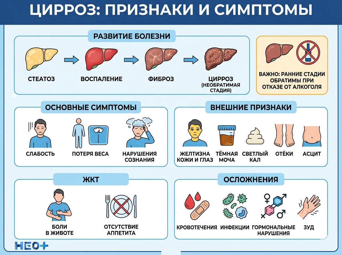 Признаки и симптомы цирроза инфографика