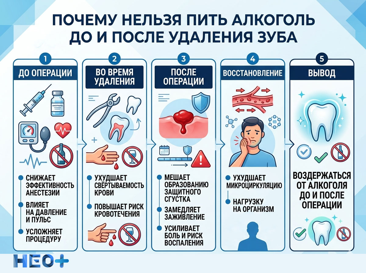 Почему нельзя пить алкоголь до и после удаления зуба инфографика
