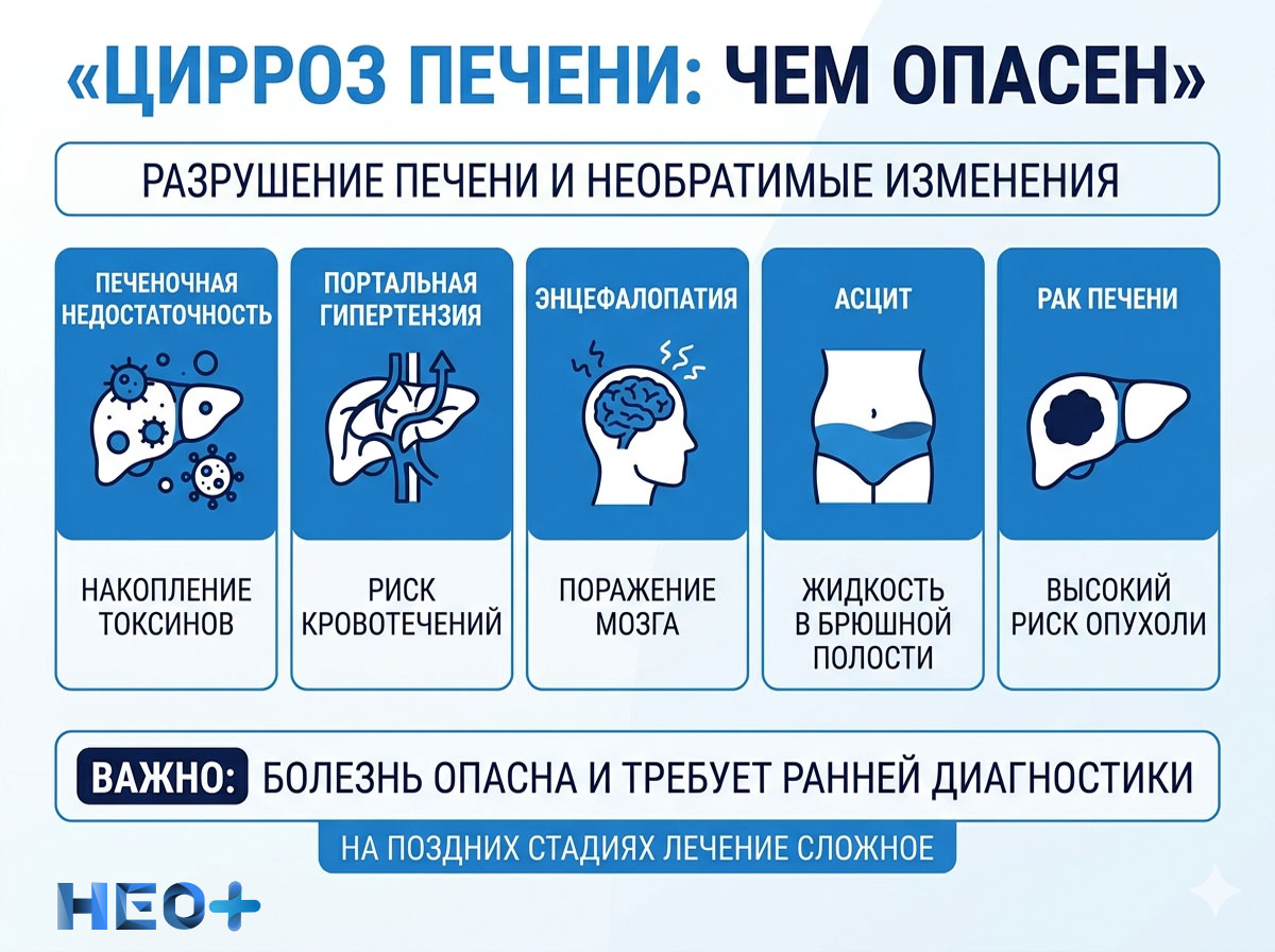 Инфографика цирроз печени: чем опасен
