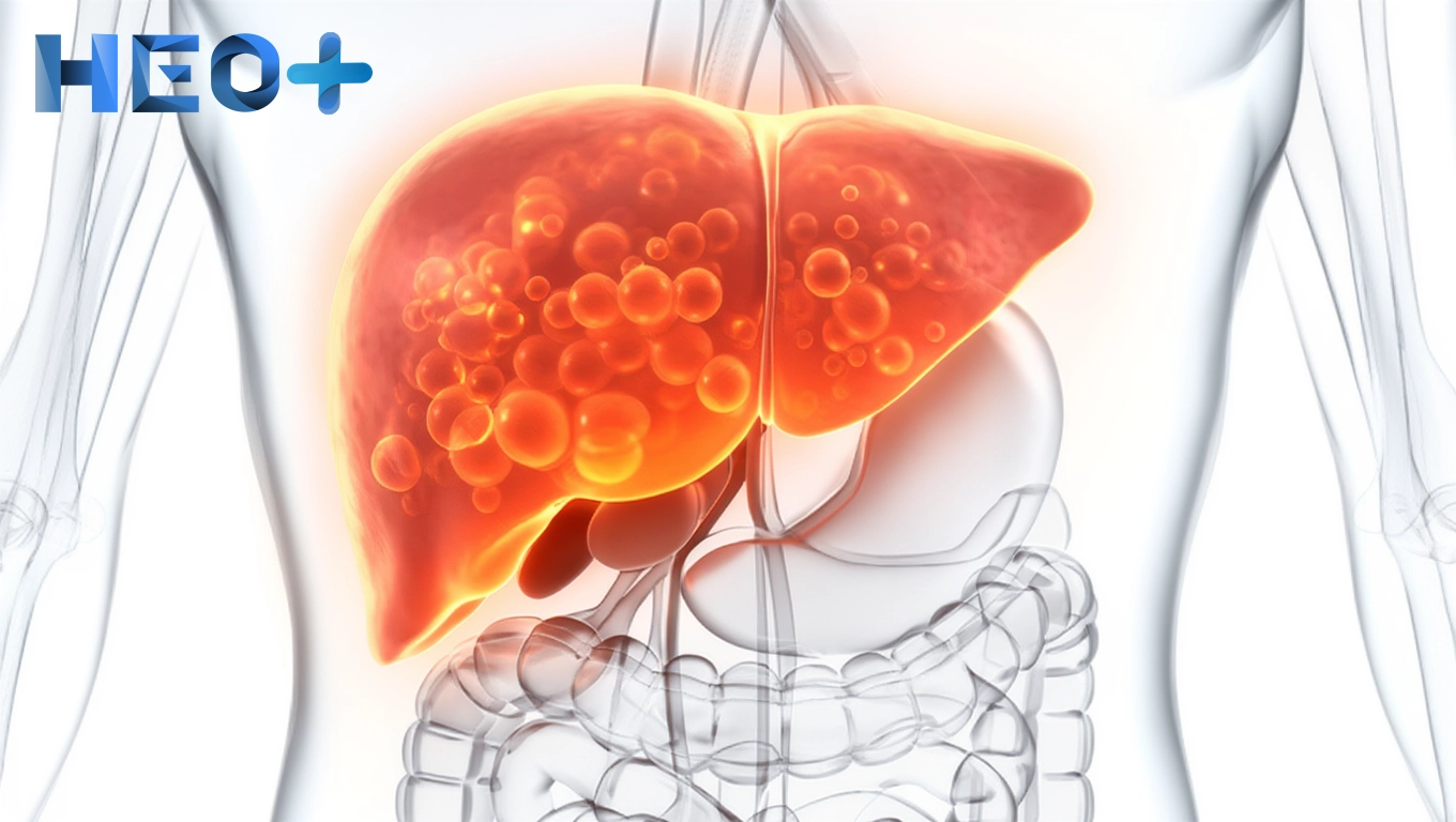 Цирроз печени